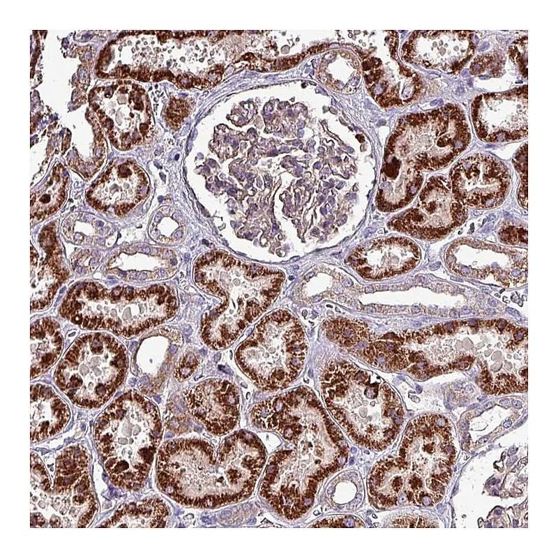 Atlas Antibodies Anti-ZNF322 Antibody