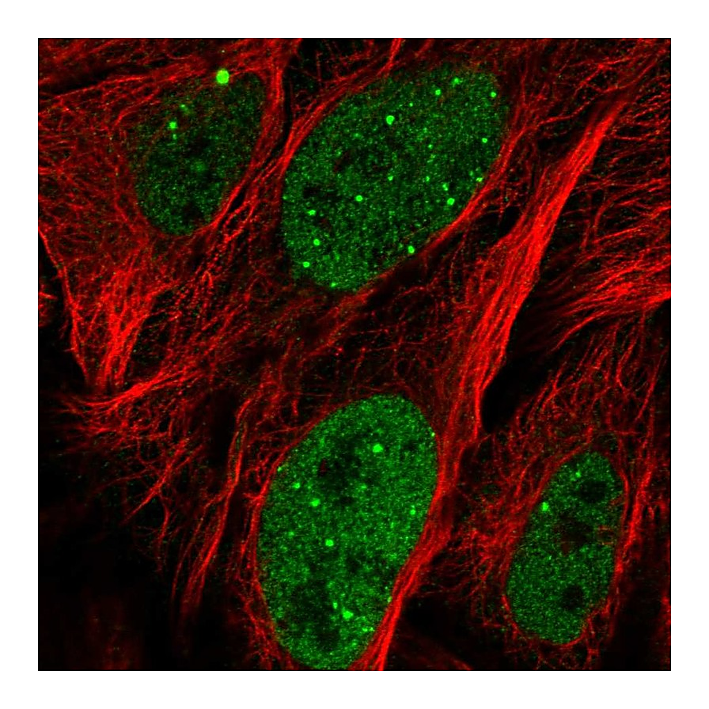 Atlas Antibodies Anti-ZNF32 Antibody