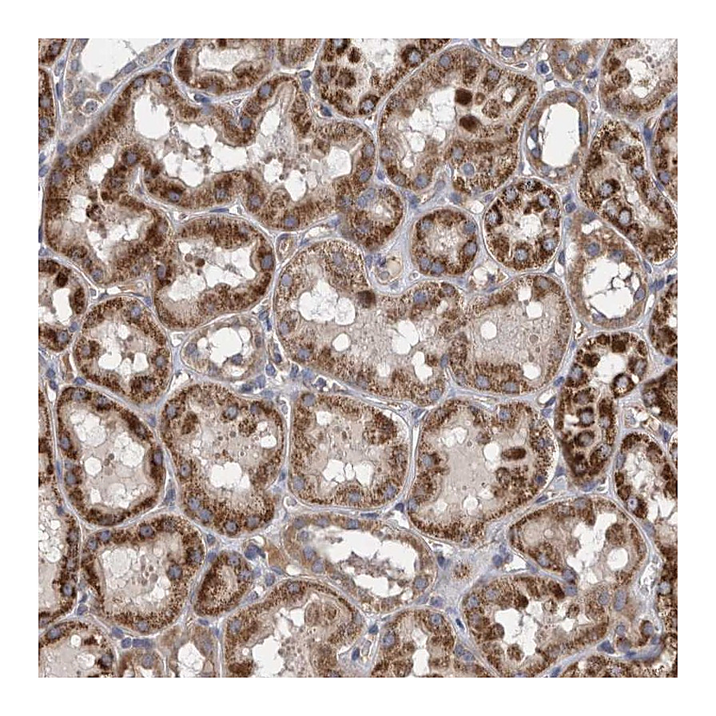 Atlas Antibodies Anti-ZNF324B Antibody