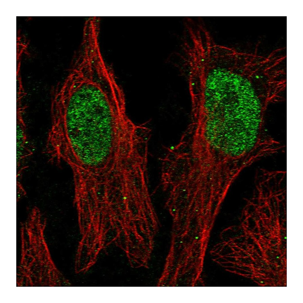 Atlas Antibodies Anti-ZNF320 Antibody