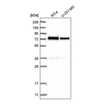 Atlas Antibodies Anti-ZNF326 Antibody