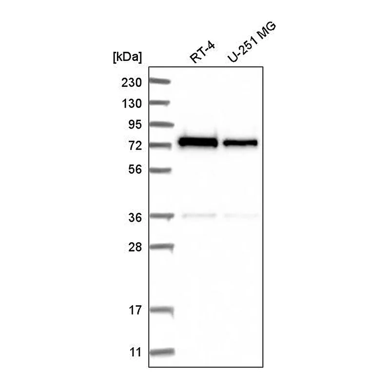 Atlas Antibodies Anti-ZNF326 Antibody