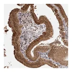 Atlas Antibodies Anti-ZNF326 Antibody
