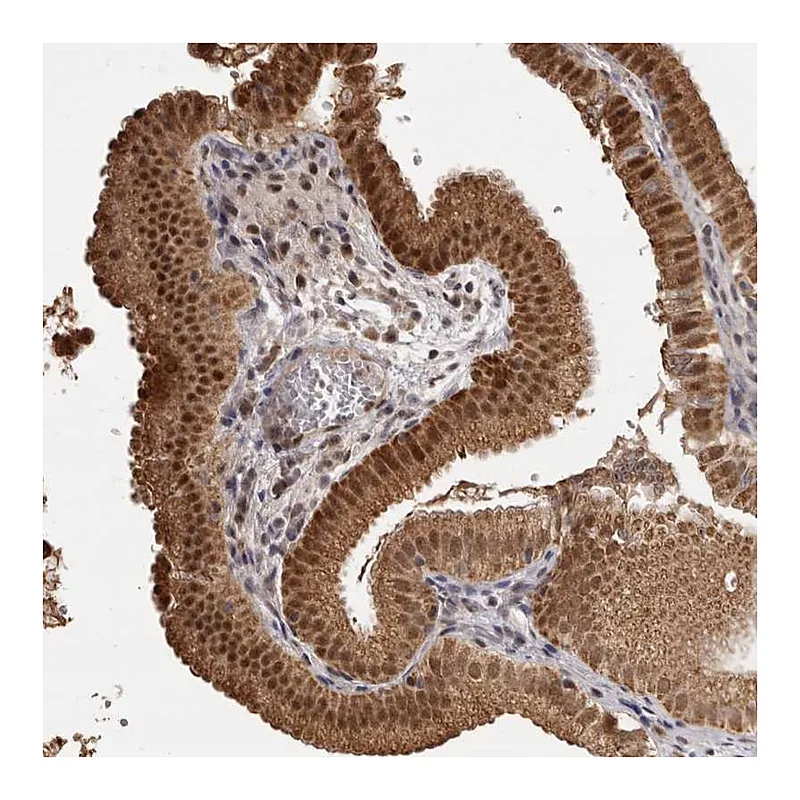 Atlas Antibodies Anti-ZNF326 Antibody