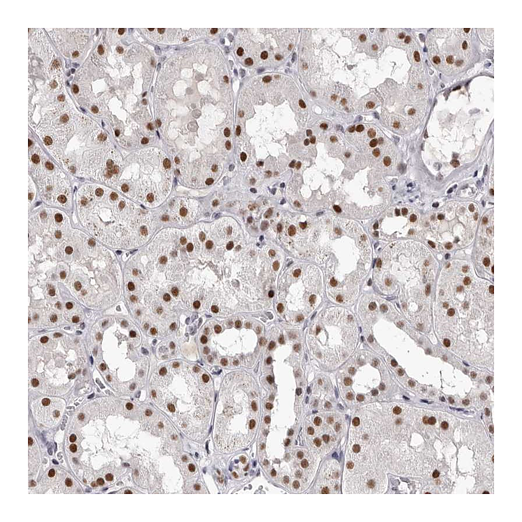 Atlas Antibodies Anti-ZNF326 Antibody