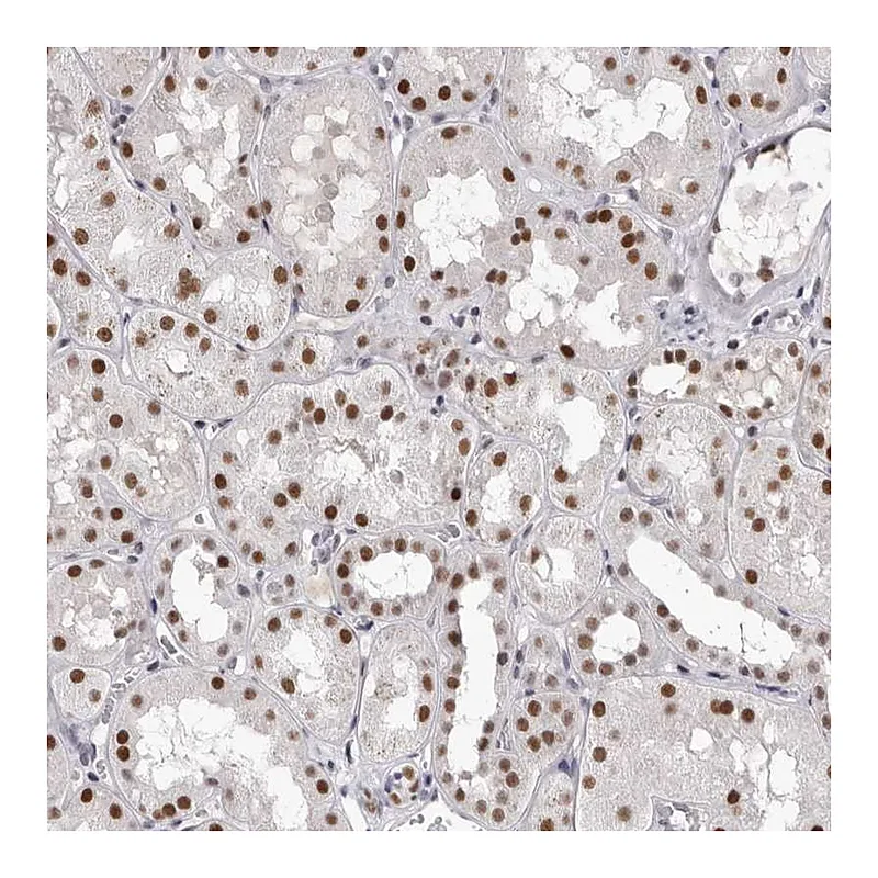 Atlas Antibodies Anti-ZNF326 Antibody