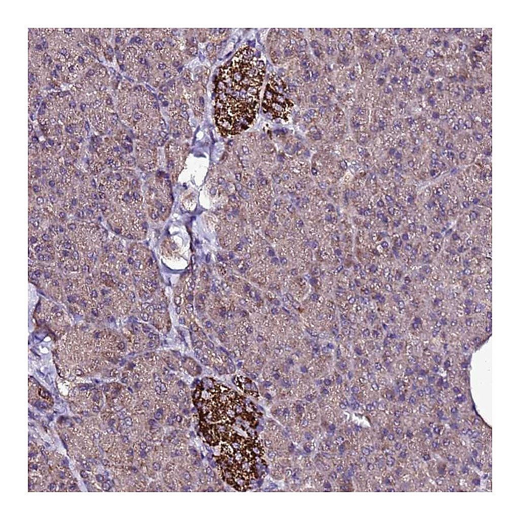 Atlas Antibodies Anti-ZNF329 Antibody