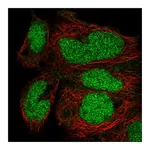Atlas Antibodies Anti-ZNF331 Antibody
