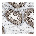 Atlas Antibodies Anti-ZNF330 Antibody