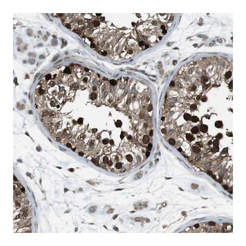 Atlas Antibodies Anti-ZNF330 Antibody