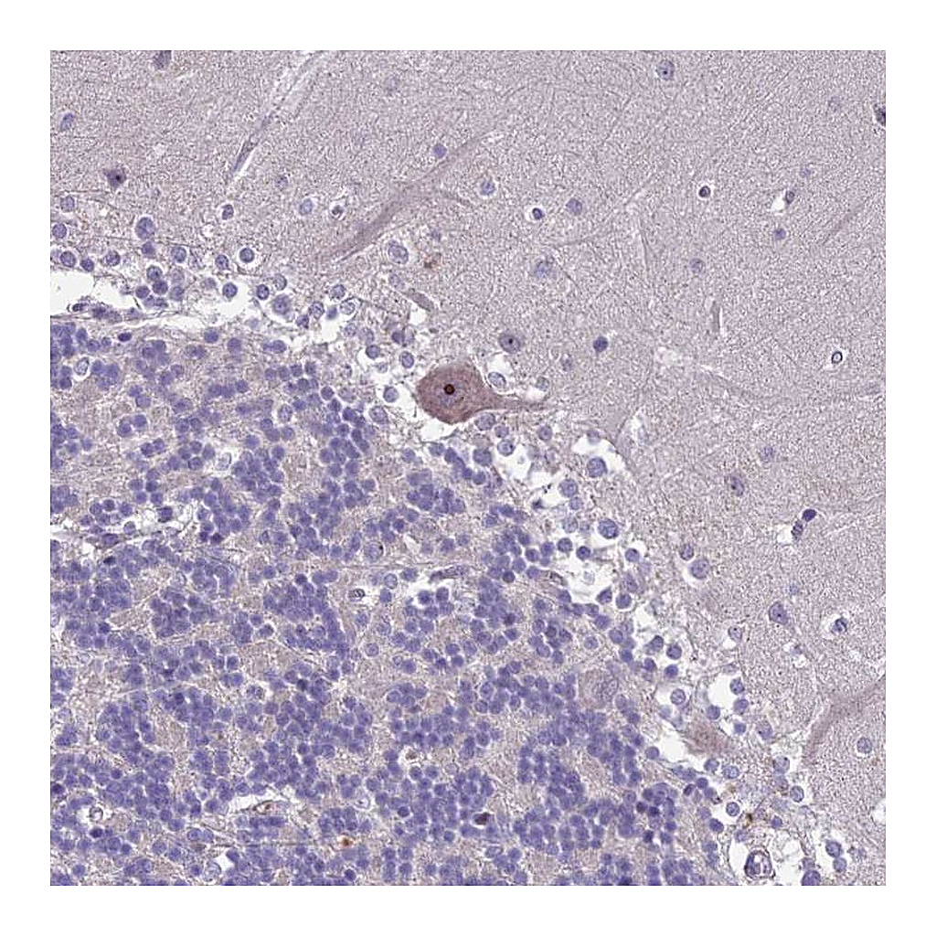 Atlas Antibodies Anti-ZNF333 Antibody