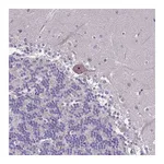 Atlas Antibodies Anti-ZNF333 Antibody