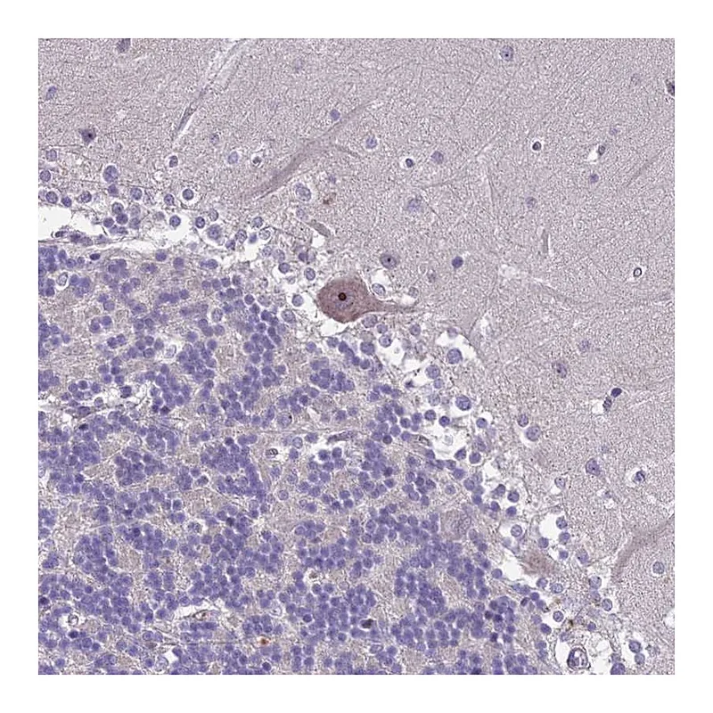 Atlas Antibodies Anti-ZNF333 Antibody