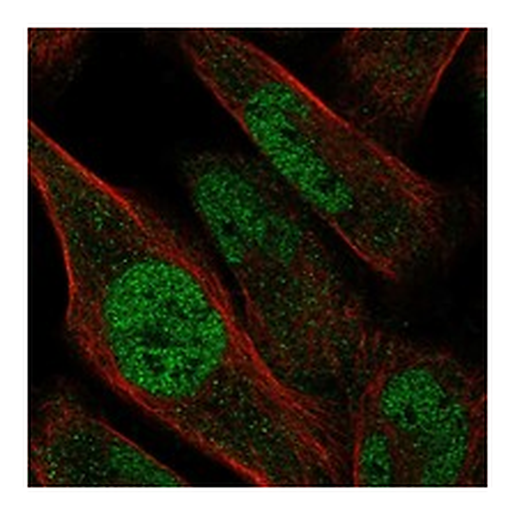 Atlas Antibodies Anti-ZNF329 Antibody