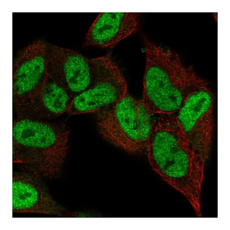 Atlas Antibodies Anti-ZNF333 Antibody