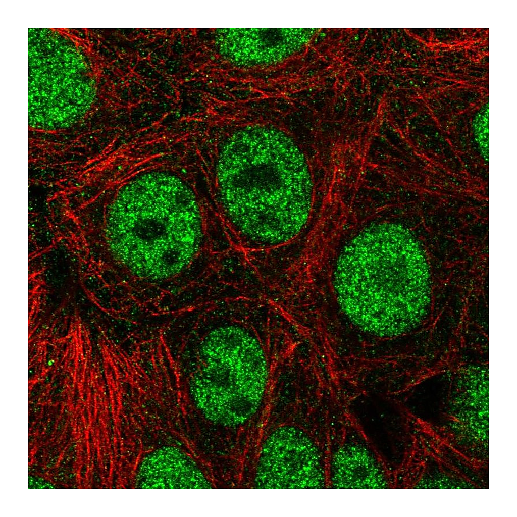 Atlas Antibodies Anti-ZNF335 Antibody