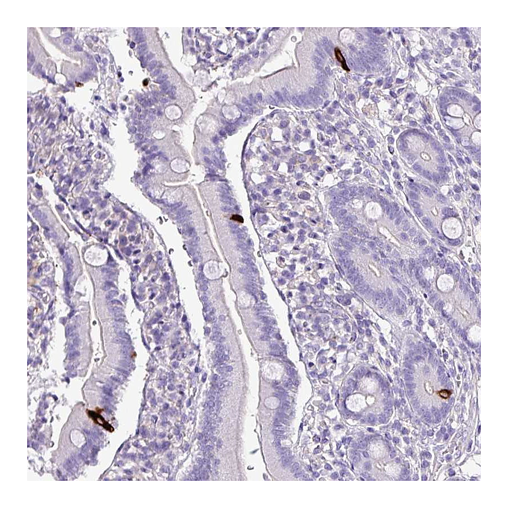 Atlas Antibodies Anti-ZNF334 Antibody