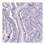 Atlas Antibodies Anti-ZNF334 Antibody
