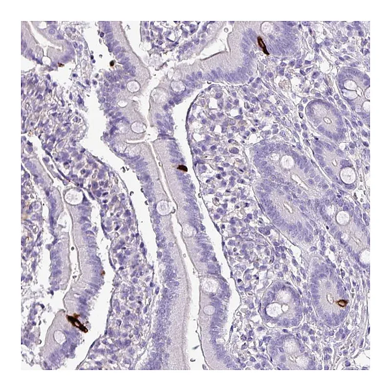Atlas Antibodies Anti-ZNF334 Antibody