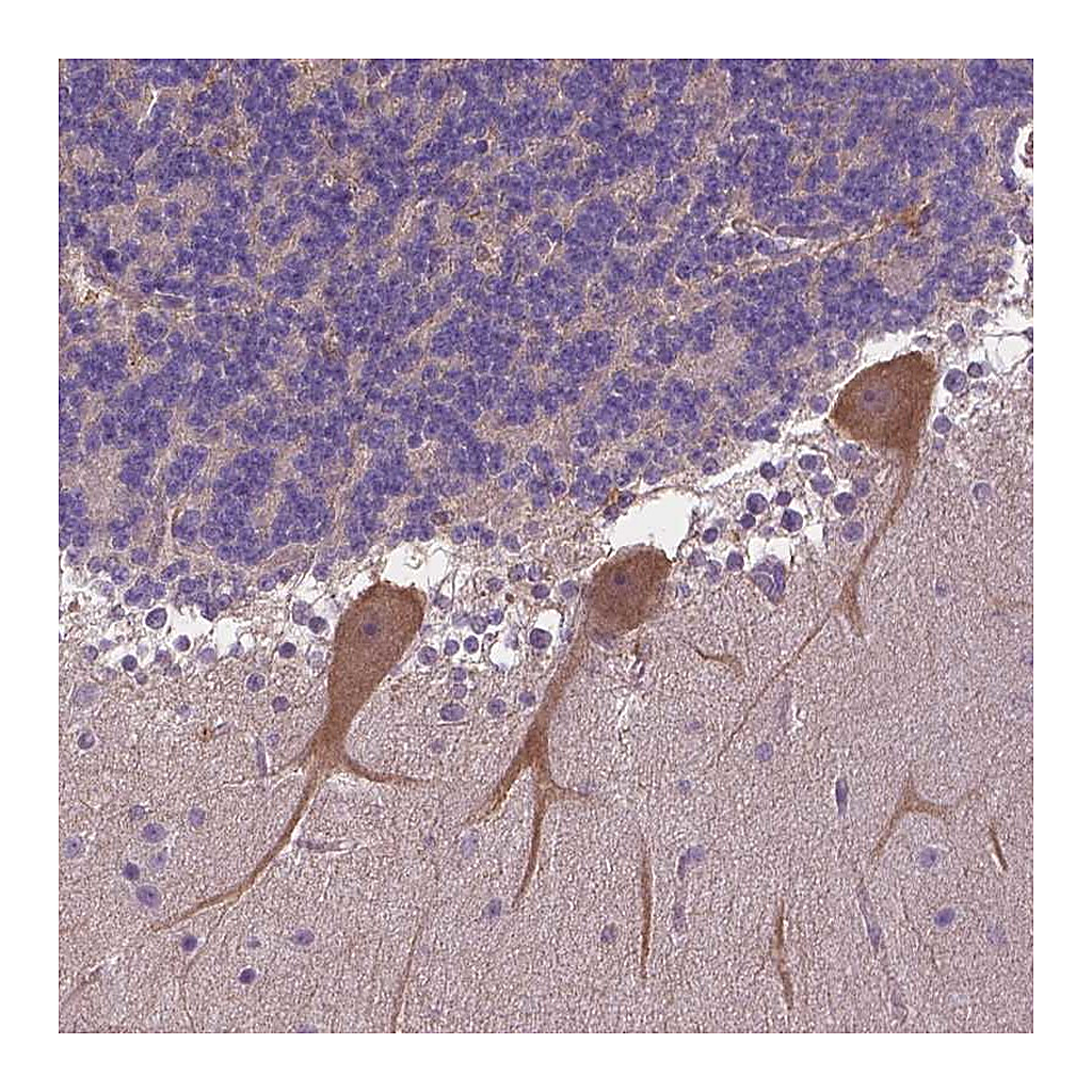 Atlas Antibodies Anti-ZNF337 Antibody