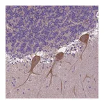 Atlas Antibodies Anti-ZNF337 Antibody