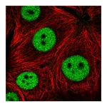 Atlas Antibodies Anti-ZNF335 Antibody