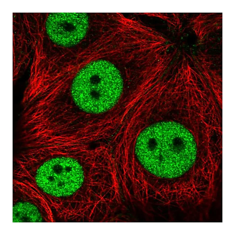 Atlas Antibodies Anti-ZNF335 Antibody
