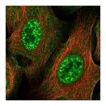 Atlas Antibodies Anti-ZNF337 Antibody