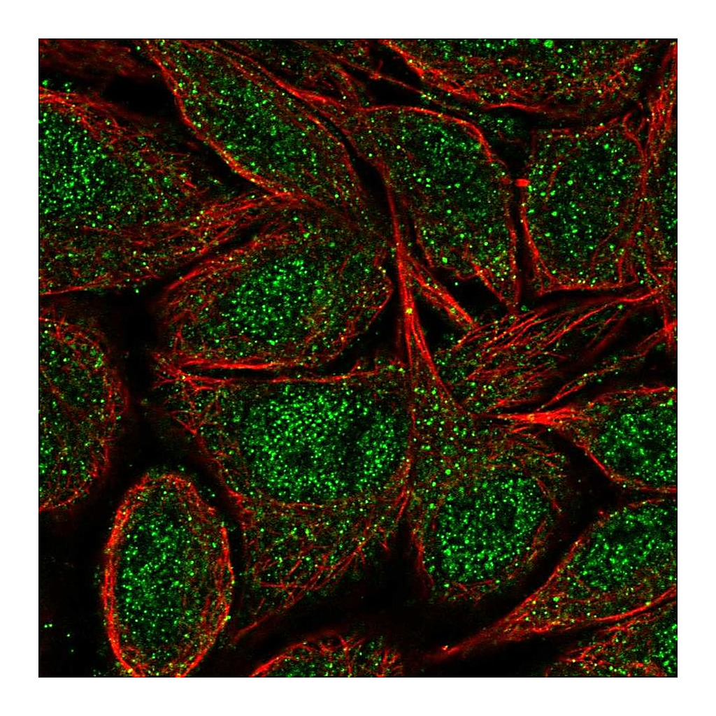 Atlas Antibodies Anti-ZNF34 Antibody