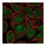 Atlas Antibodies Anti-ZNF34 Antibody