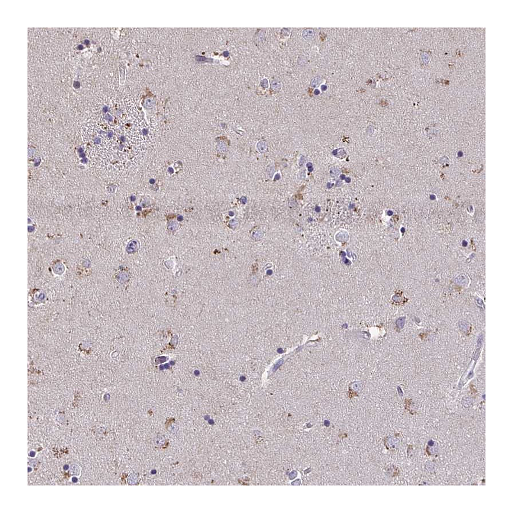 Atlas Antibodies Anti-ZNF34 Antibody