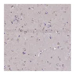 Atlas Antibodies Anti-ZNF34 Antibody