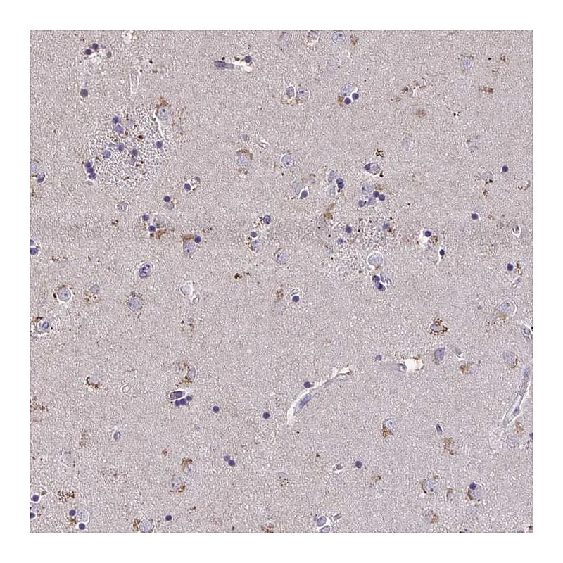 Atlas Antibodies Anti-ZNF34 Antibody