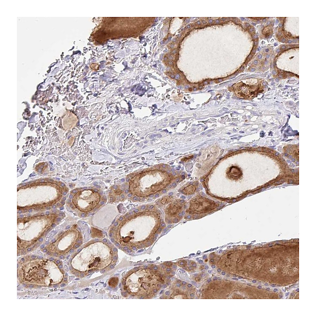 Atlas Antibodies Anti-ZNF33A Antibody
