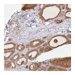 Atlas Antibodies Anti-ZNF33A Antibody