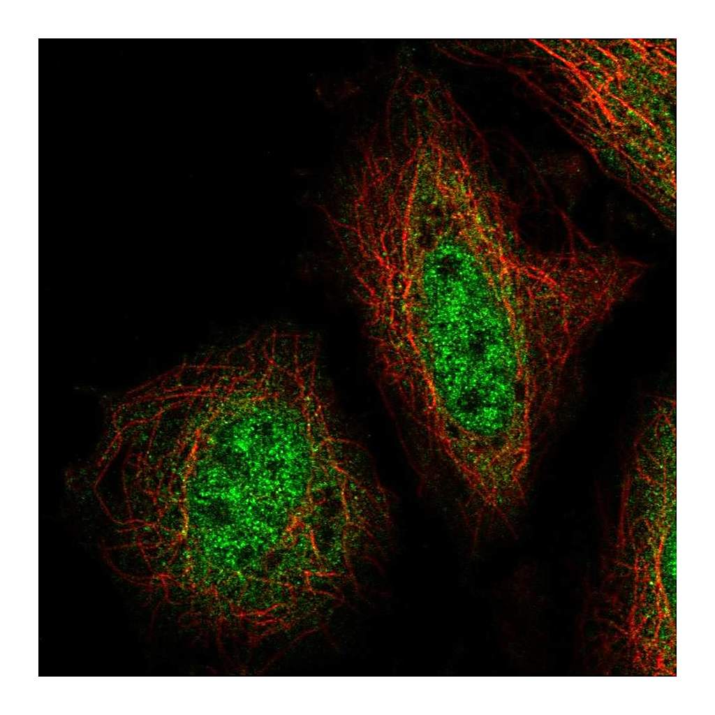 Atlas Antibodies Anti-ZNF34 Antibody