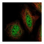 Atlas Antibodies Anti-ZNF34 Antibody