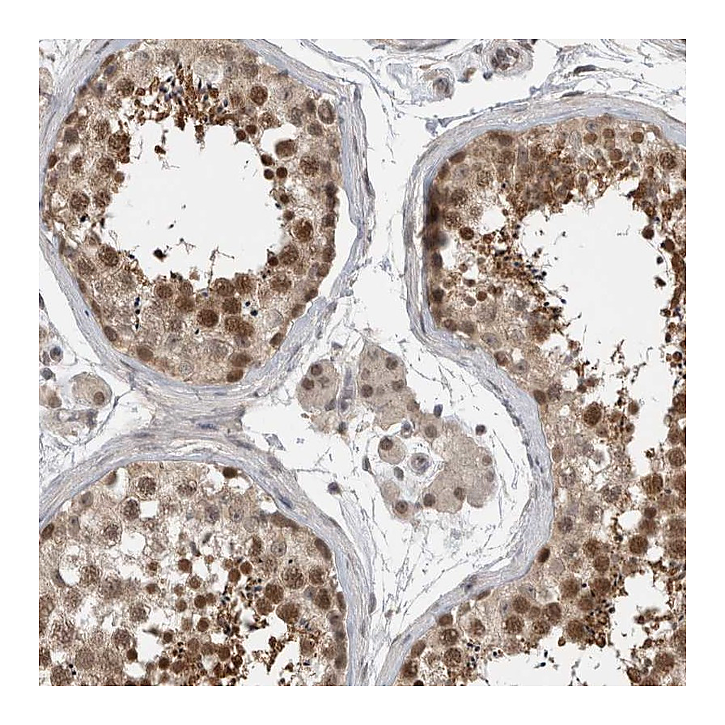 Atlas Antibodies Anti-ZNF341 Antibody