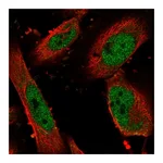 Atlas Antibodies Anti-ZNF343 Antibody