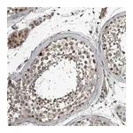 Atlas Antibodies Anti-ZNF345 Antibody