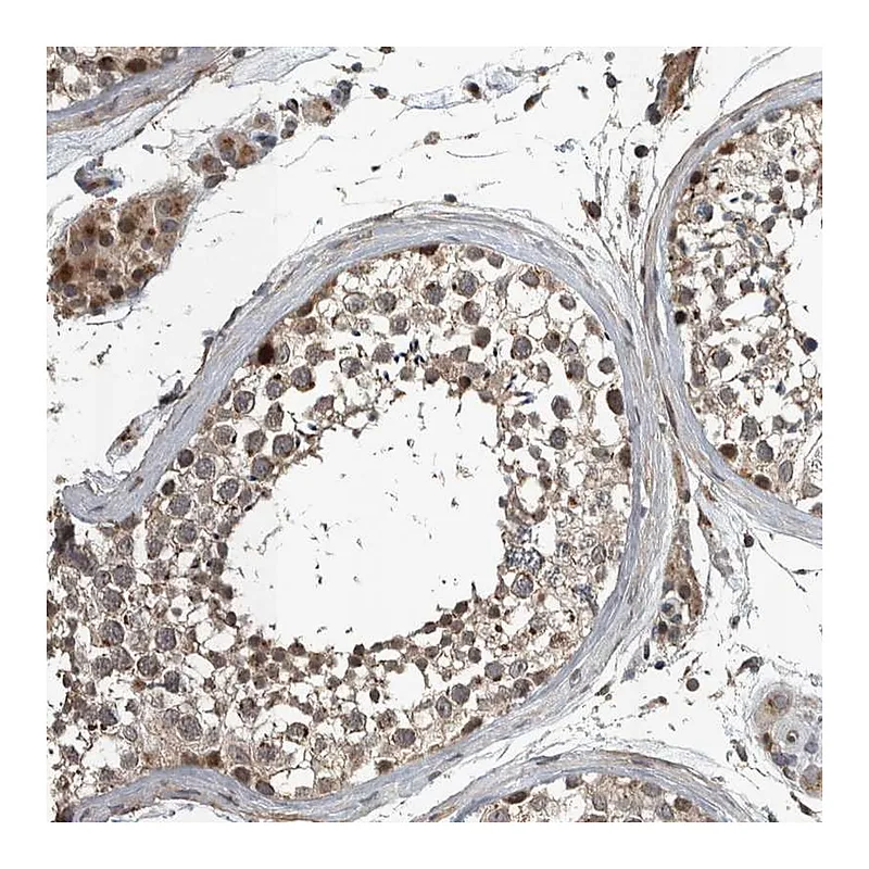 Atlas Antibodies Anti-ZNF345 Antibody