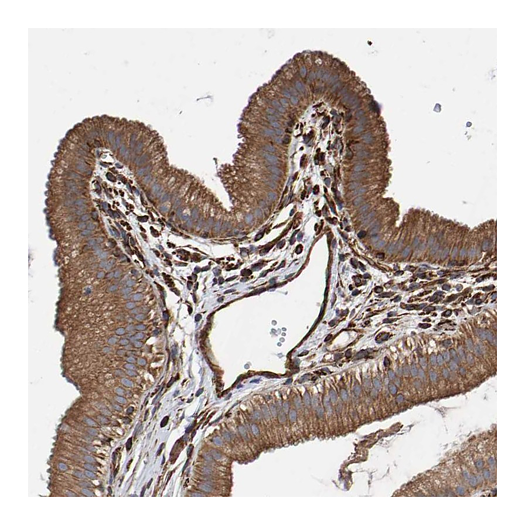 Atlas Antibodies Anti-ZNF347 Antibody