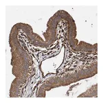 Atlas Antibodies Anti-ZNF347 Antibody