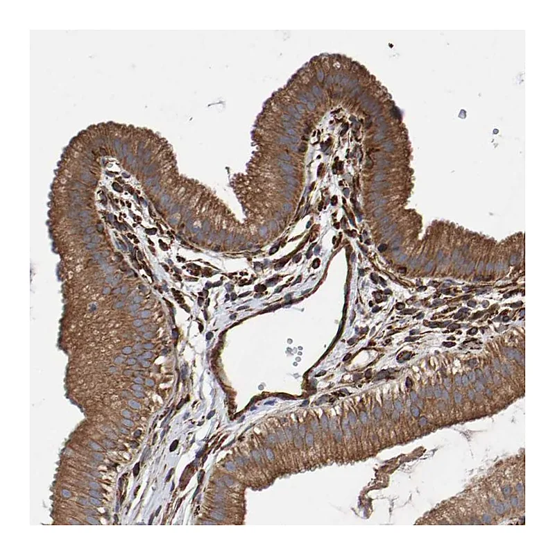 Atlas Antibodies Anti-ZNF347 Antibody