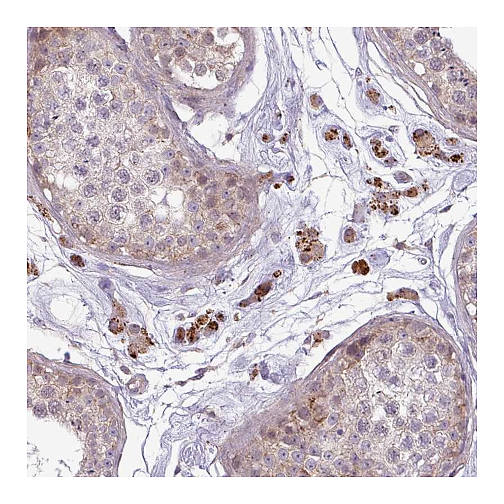 Atlas Antibodies Anti-ZNF35 Antibody