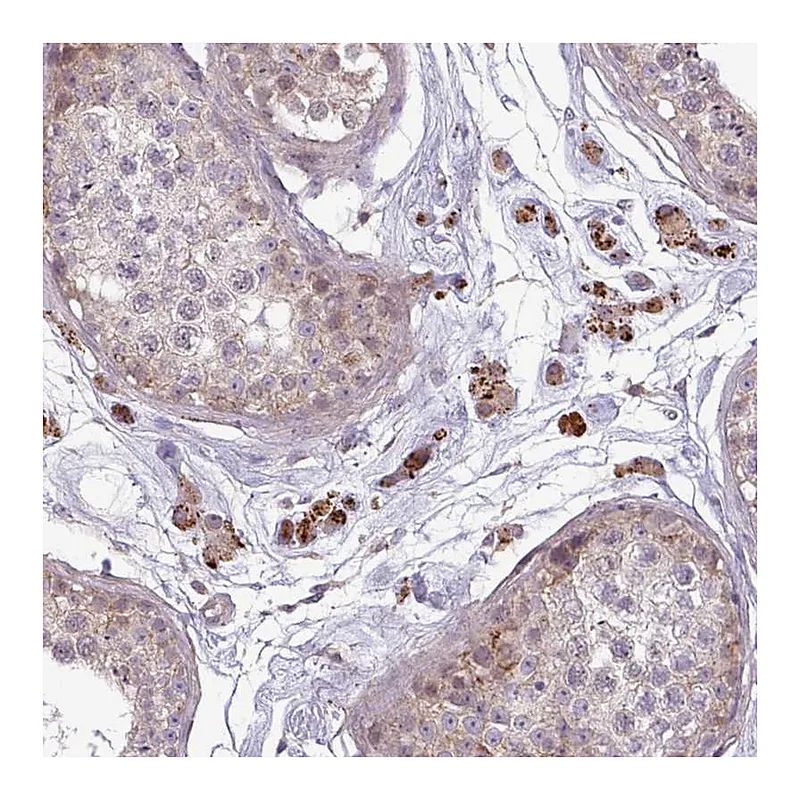 Atlas Antibodies Anti-ZNF35 Antibody