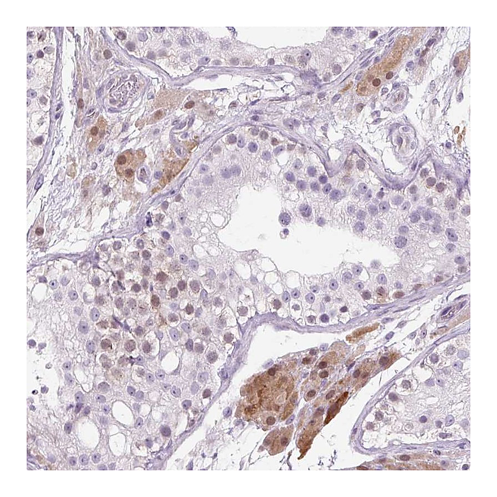 Atlas Antibodies Anti-ZNF35 Antibody