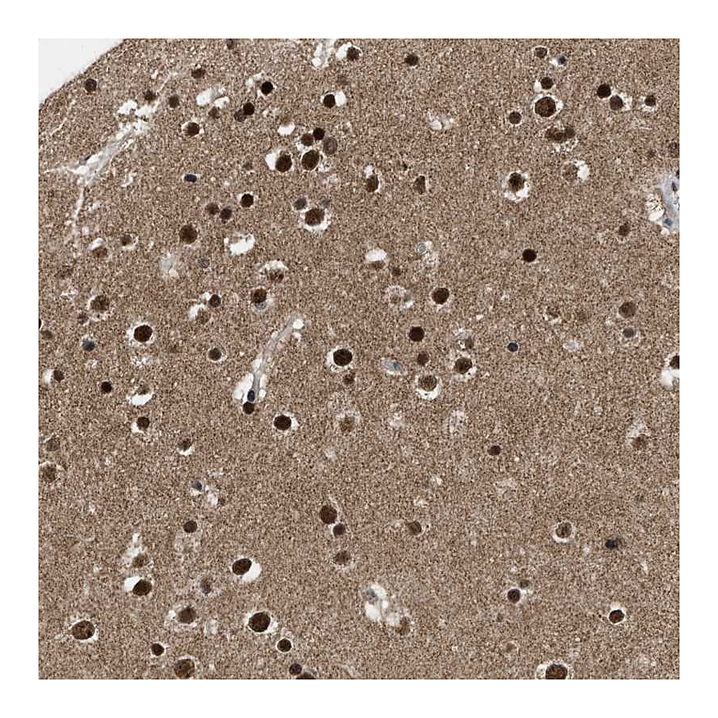 Atlas Antibodies Anti-ZNF346 Antibody