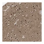 Atlas Antibodies Anti-ZNF346 Antibody