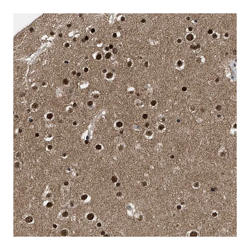 Atlas Antibodies Anti-ZNF346 Antibody